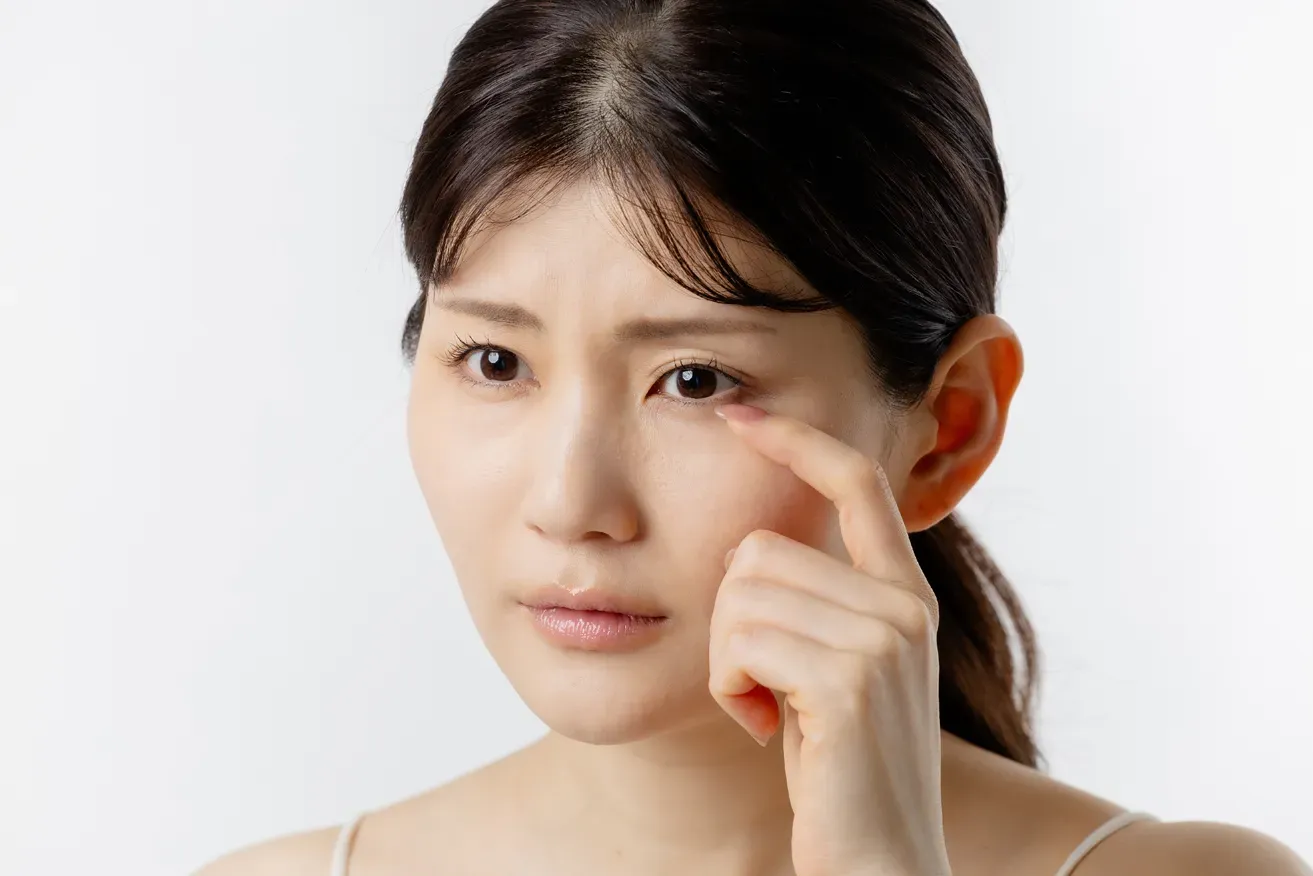 Concerned woman touching her eye bags